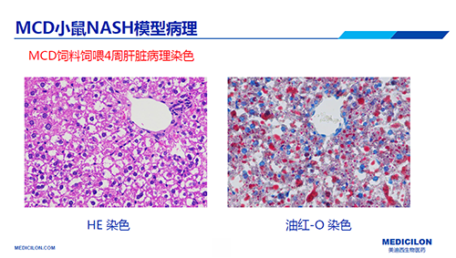 小鼠NASH模型