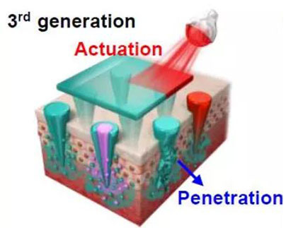 第三代：通过微针介导的皮肤层破坏和微针伴随的各种功能增强药物转运.jpg