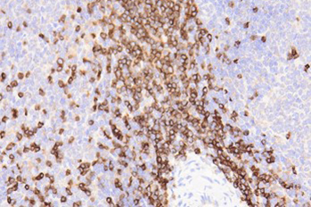 IHC-CD3.jpg