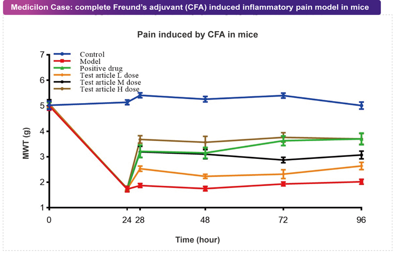 人生就是博案例：CFA致痛模型.jpg